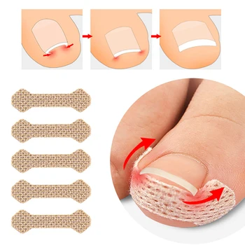 Пластыри для ногтей Для лечения паронихии С корректорами для ногтей и фиксирующими приспособлениями Для восстановления ухода за косточками на ногах.